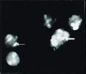 PAB12376 - Размер: 100 микролитров - Заешки поликлональные антитела срещу NCL - Всяка (по 100 микролитров)