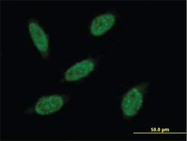 H00056254-B01 - Мишка поликлональные антитела към RNF20 - Всяко (50 мл)